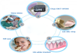 Quy trình cắm răng Implant diễn ra như thế nào?