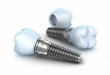 Cập nhật bảng giá ghép răng Implant mới nhất 2018