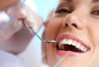 Điều trị tủy răng mất bao lâu? Thời gian điều trị tủy răng