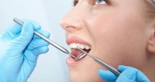 Những lưu ý khi cấy ghép răng implant là gì để nhanh phục hồi?