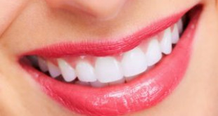 Giải đáp thắc mắc “tẩy trắng răng bằng laser” có tốt không?