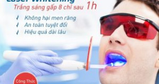 Sự thật về tẩy trắng răng bằng laser có hại không? >>> Tin Hot