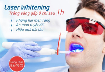Sự thật về tẩy trắng răng bằng laser có hại không? >>> Tin Hot