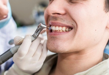 Bác sĩ tư vấn khiến bạn bất ngờ “Lấy cao răng có an toàn không?”