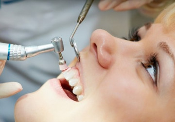 Bạn đang thắc mắc cạo vôi răng thường xuyên tốt hay không? >>> Xem nhanh