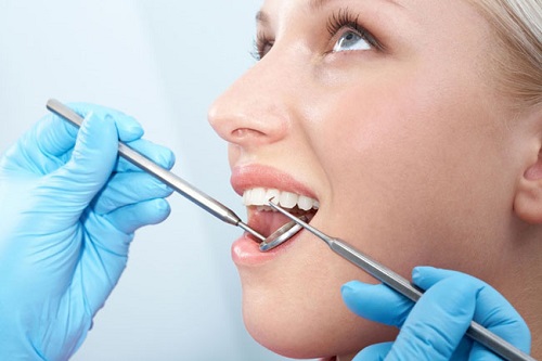 răng Implant là gì 