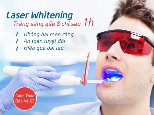 Nhuộm răng trắng 2