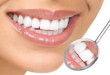 Siêu lợi ích từ ” Dầu Ô LIU” làm trắng răng. << CLICK TẠI ĐÂY