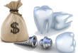 Chi phí làm răng Implant là bao nhiêu?