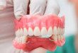Cấy ghép implant cho người mất nhiều răng có được không? << Xem ngay