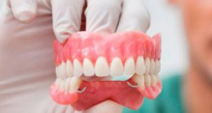 Cấy ghép implant cho người mất nhiều răng có được không? << Xem ngay